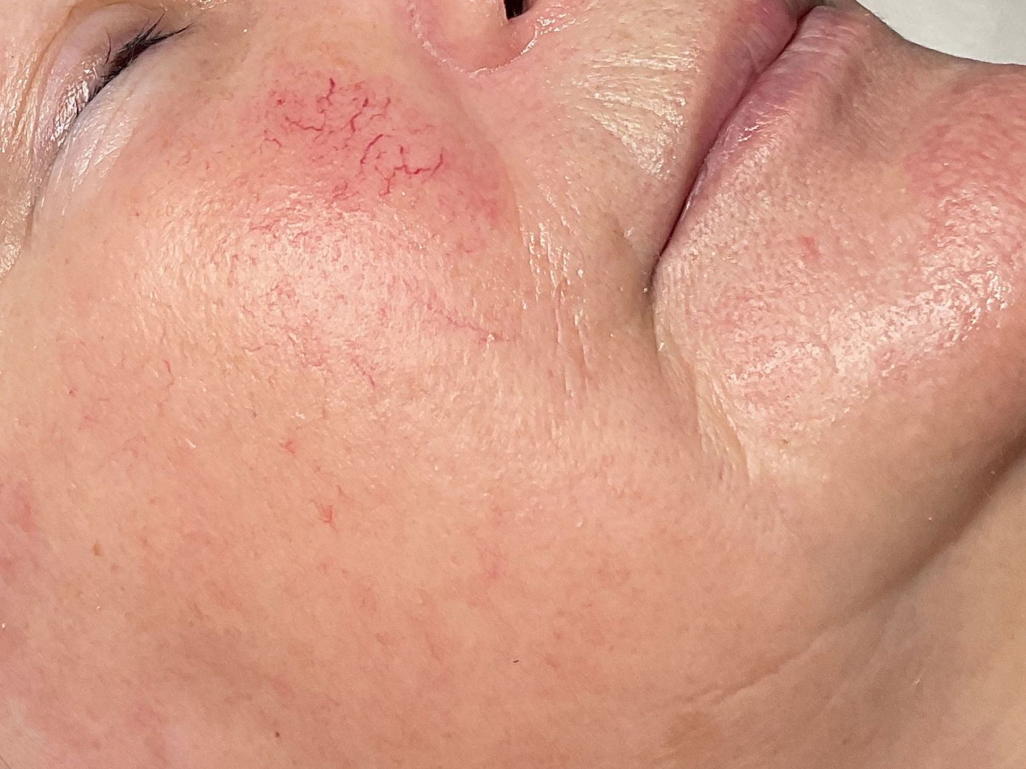 Kundin nach Biome-Facial Behandlung