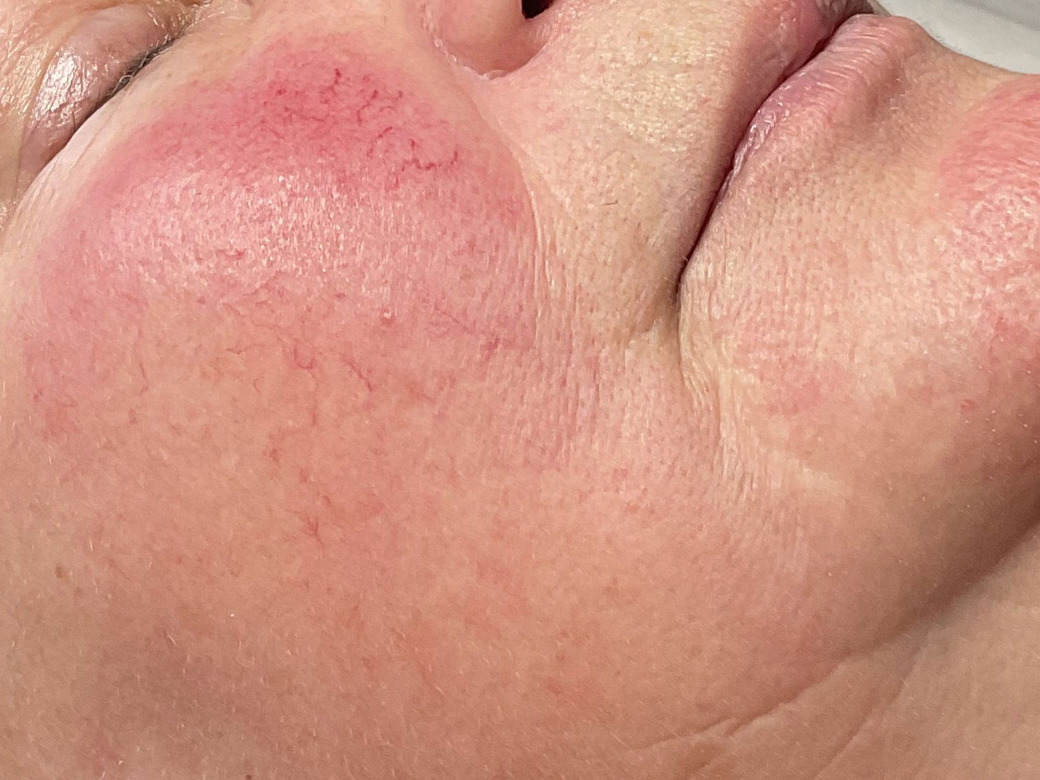 Kundin vor Biome-Facial Behandlung